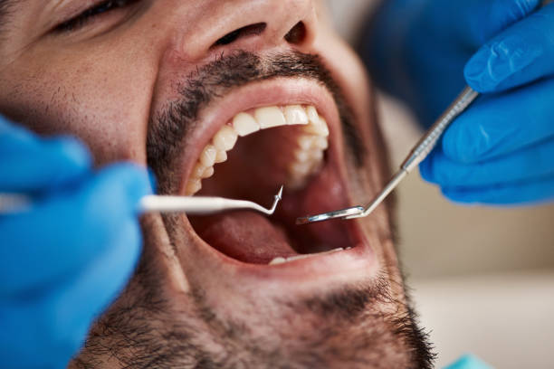Best Urgent Care for Lost Fillings or Crowns in Eddystone, PA